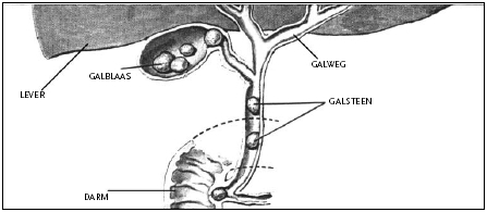 galblaas